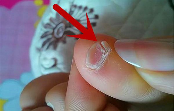 小脚趾甲分瓣是哪族人