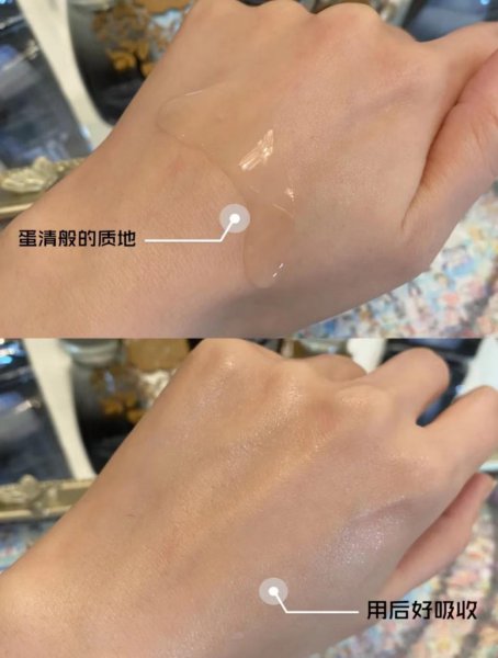 小黑瓶和小棕瓶哪个精华好用