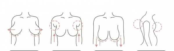 调整型内衣能改善胸型吗