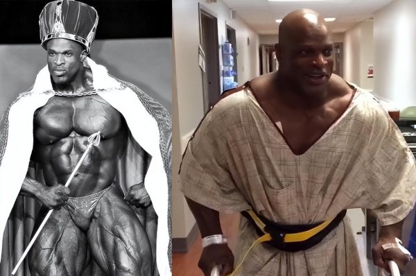 健美罗尼库尔曼现状