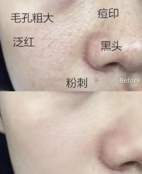 上海硫磺皂可以洗脸吗