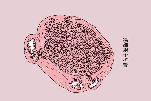 臭豆腐为什么这么臭