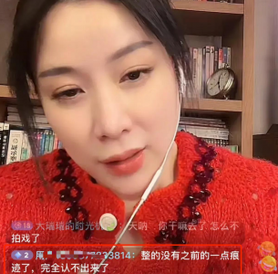整容失败的女星有哪些 因为整容葬送前途的女明星盘点