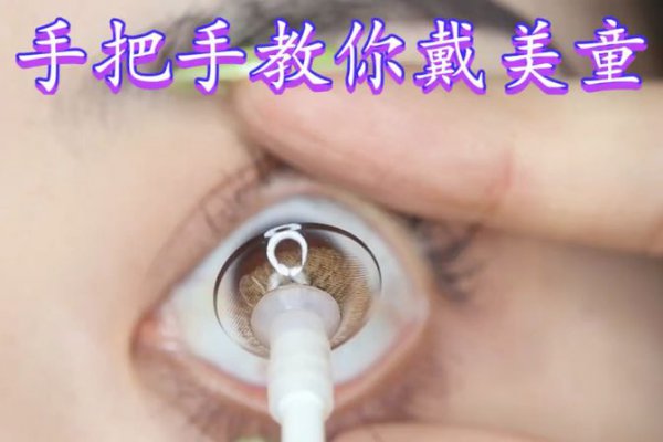 隐形眼镜怎么戴最方便