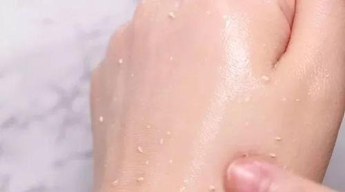 脸上搓出白泥是角质吗
