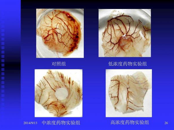 科研论文中p值和显著性水平的关系