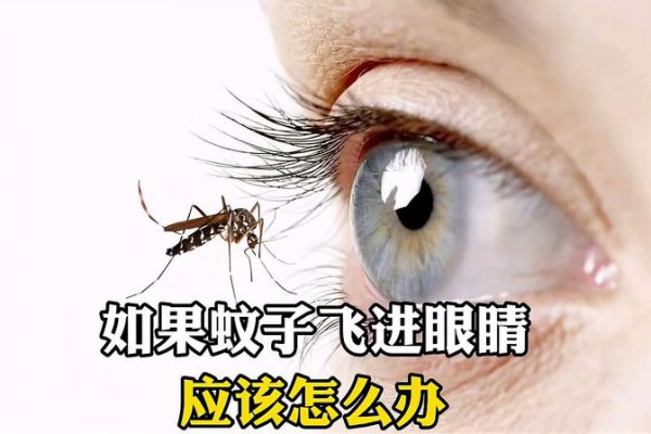 蚊子进眼怎么处理