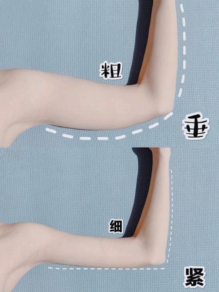 女生麒麟臂是什么意思？能减下来吗？