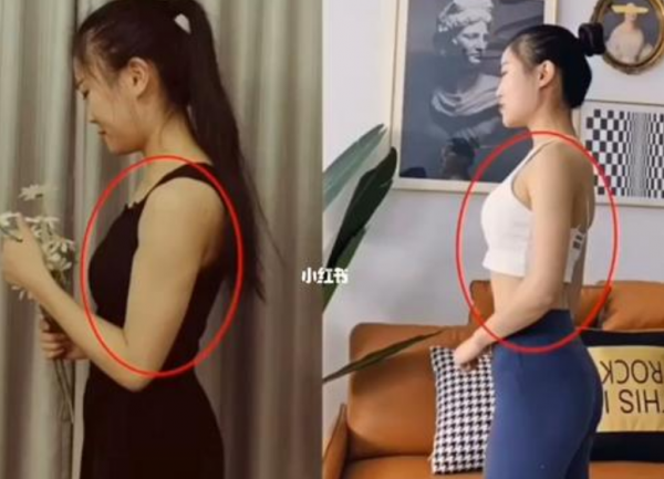 女生麒麟臂是什么意思？能减下来吗？