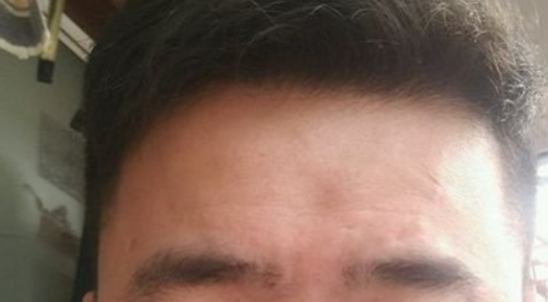 男人印堂凹陷是什么征兆
