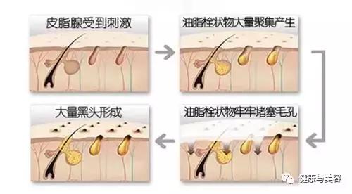 教你有效去黑头、收毛孔！