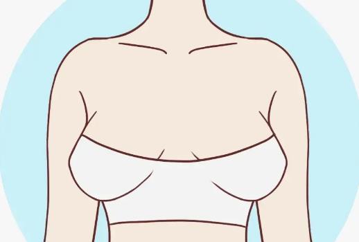 女生胸型有几种类型