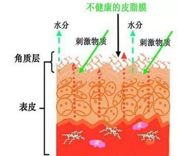 角质层薄怎么修复