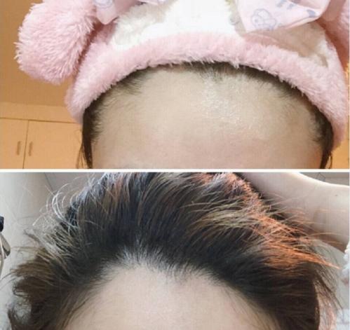 发际线粉怎么涂比较自然