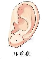 女人注定不平凡的痣