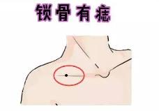 女人注定不平凡的痣