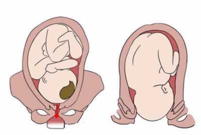 产后多久下面会变紧 女人顺产后几个月变紧