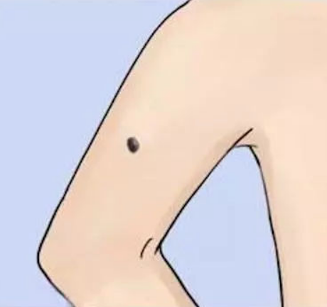 女孩左胳膊长痣代表什么意思