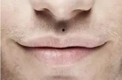 男人人中有痣是福是祸