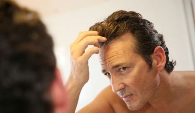 脱发怎么治疗最好 减少掉发有妙方