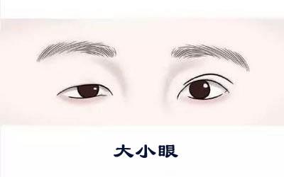 左双右单才是真正的龙凤眼的女生