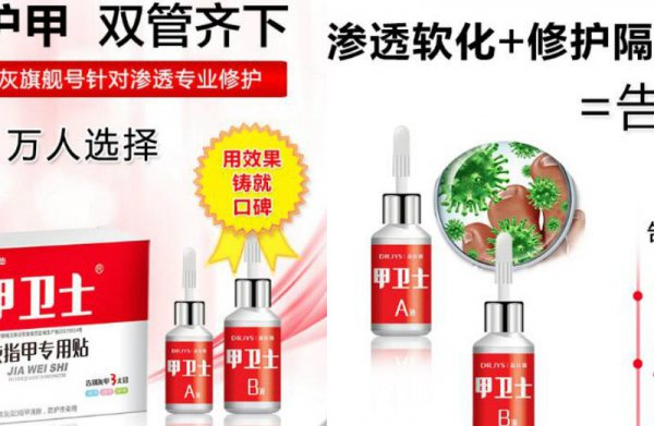 灰指甲最有效的外用药
