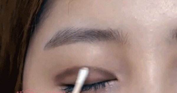单眼皮怎么变双眼皮？