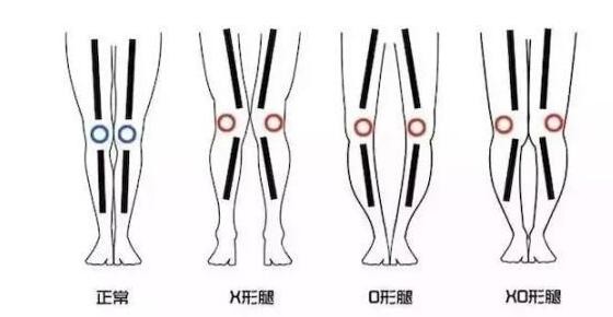 根据腿型挑选牛仔裤