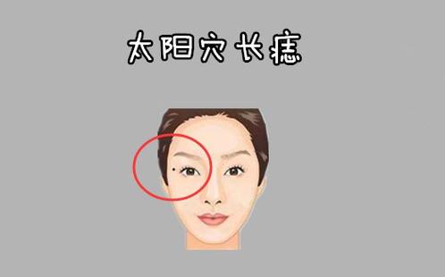 女孩右太阳边上有个痣好吗