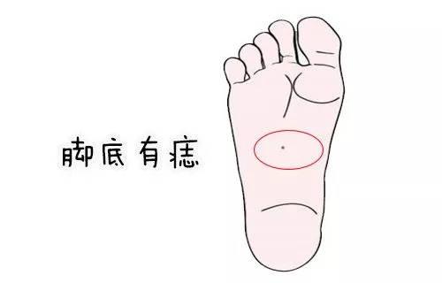 女人左脚底有痣好不好，代表什么