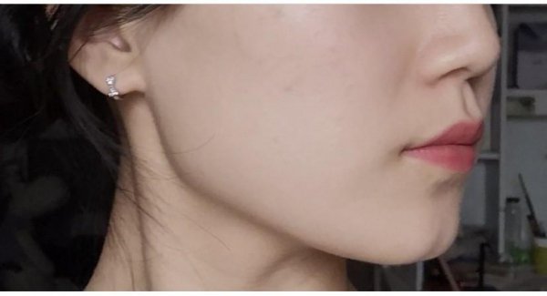 美人沟下巴的人很少吗