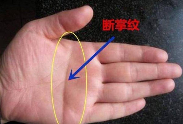 为什么假断掌要比真断掌要好很多