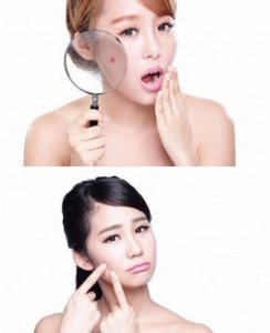 红斑狼疮怎么引起的？找准病因得到根治