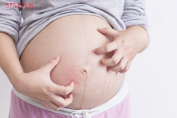 肥胖纹和妊娠纹分别是怎样的？