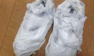 白色的鞋子晒了发黄了怎么办 白色的鞋子晒了发黄了有什么方法