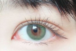​ 美瞳戴久了会对眼睛有什么伤害