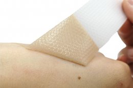 疤痕护理硅凝胶作用 自风干型疤痕护理硅凝胶效果