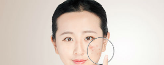 换季过敏脸怎么办