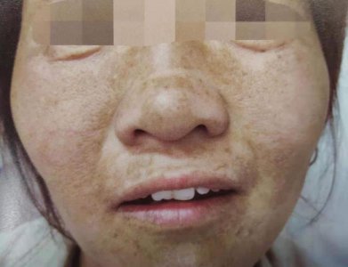 斑点线和普通线的区别 斑点线和普通线有什么不同