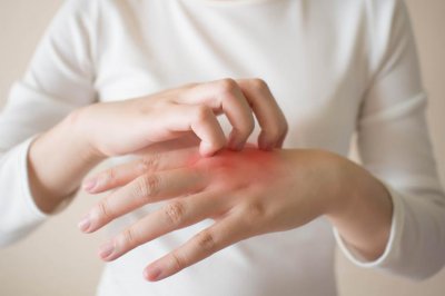 蚊子咬后涂肥皂水要洗吗 蚊子咬后涂肥皂水要洗掉吗