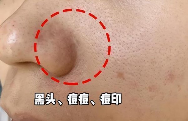 清水洗脸好吗
