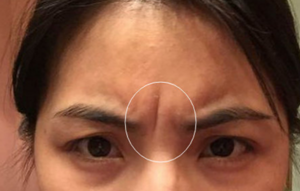 女人有悬针纹代表什么命运