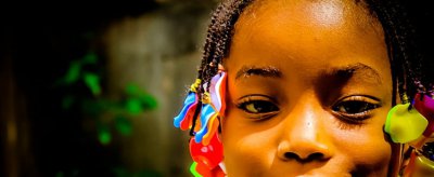 怎么改善肤色暗沉 皮肤暗沉的原因