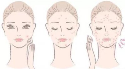 不用护肤品皮肤会变好吗 不用护肤品皮肤反而变好了