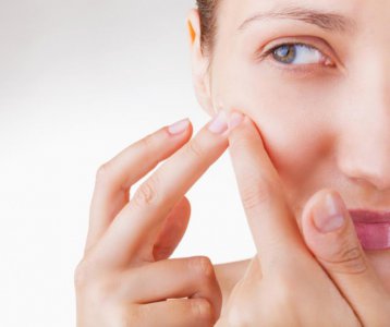 痘坑痘印能修复吗 黑色痘印去除方法