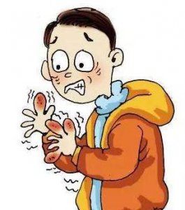 冻疮初起的时候怎么处理治疗 冻疮初期的症状