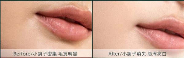 女生唇毛刮掉会越来越浓吗