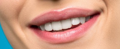 佳洁士美白牙贴禁忌 美白牙贴的种类