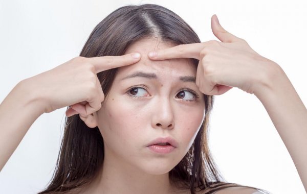 脸上长痘痘怎么办