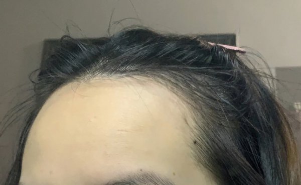 发际线高的人为啥帅
